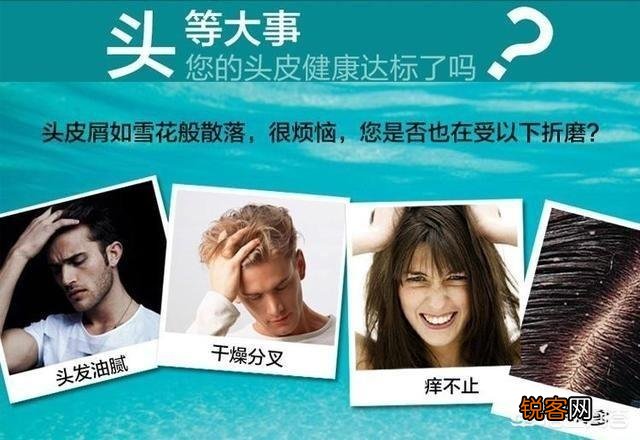 可不可以帮我推荐一个比较好的去头皮屑的洗发水,有哪些？