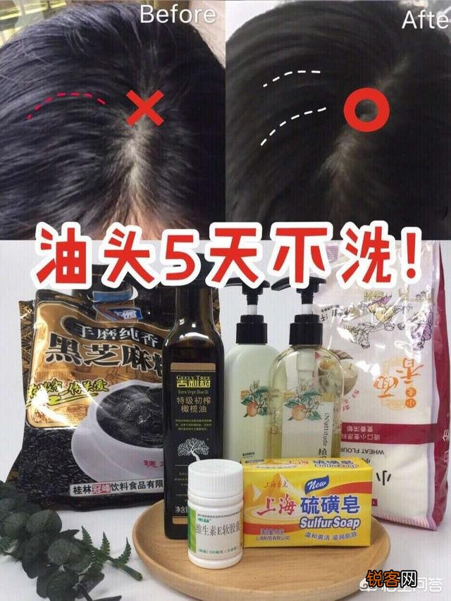什么洗发水去油？我的头发很油,隔一天不洗就很油腻怎么办？