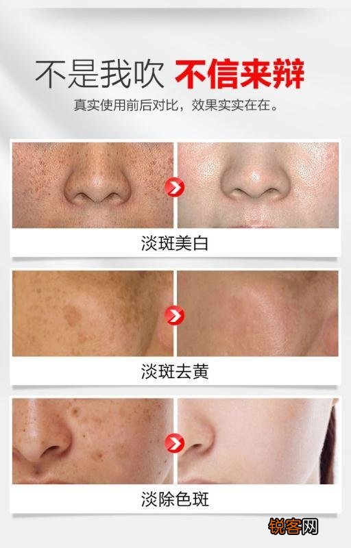 你们都是用什么护肤品来美白的呀?