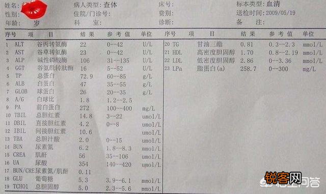 体检中的血液检验报告单重点应关注哪些项目？
