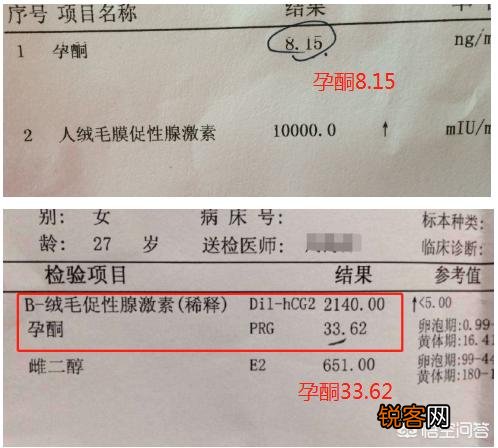 有没有谁来科普一下HCG和孕酮？