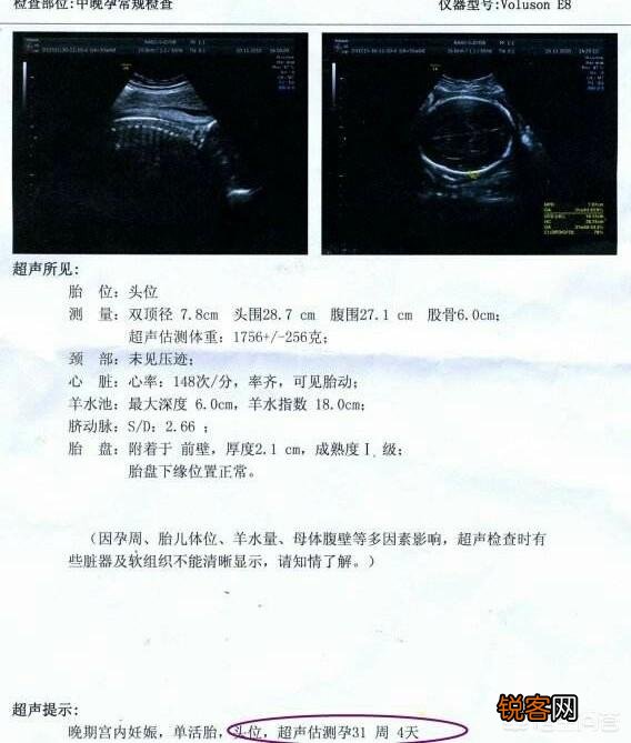 大排畸以后,为什么还要再做至少2次B超?真的重要吗?