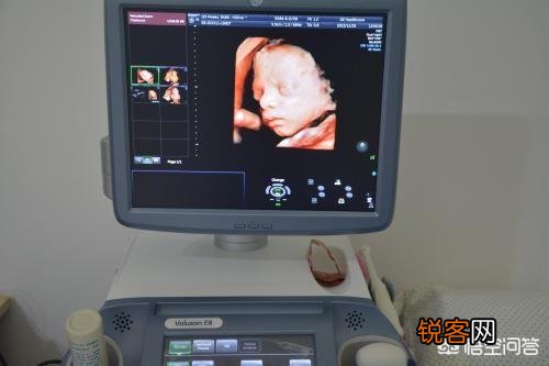 大排畸以后,为什么还要再做至少2次B超?真的重要吗?