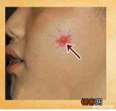 17岁高一女孩肚大如孕,去医院查出肝腹水!母亲痛哭:全都怪我啊!母亲做了什么?