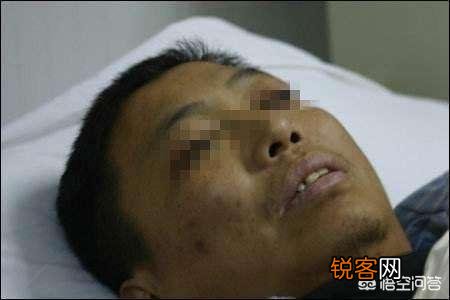 17岁高一女孩肚大如孕,去医院查出肝腹水!母亲痛哭:全都怪我啊!母亲做了什么?