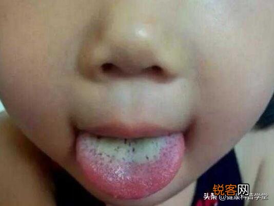 孩子正是长身体的时候,多吃点什么有利于身体发育呢？