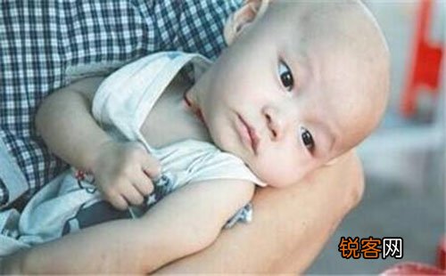 什么缘由会招致小儿脑瘫 小儿脑瘫的医治办法