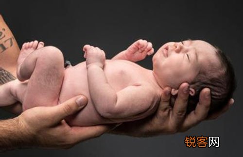 什么是重生儿湿肺？重生儿湿肺的临床表示有哪些