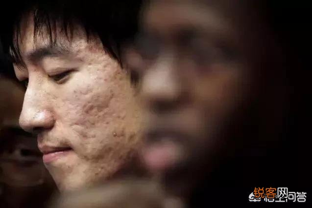 男士皮肤不好该用什么洗面奶？