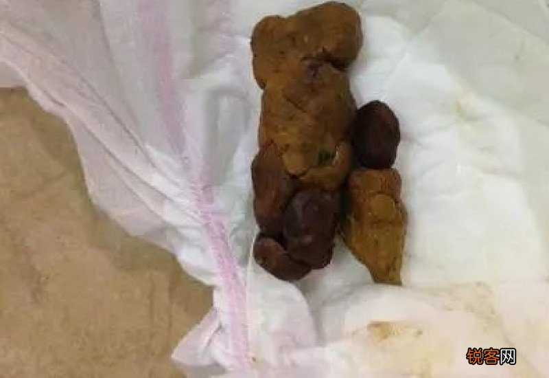 拉屎有血是什么原因
