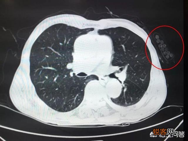 吸烟导致肺癌,哪些信号一出现说明不能再抽烟了？