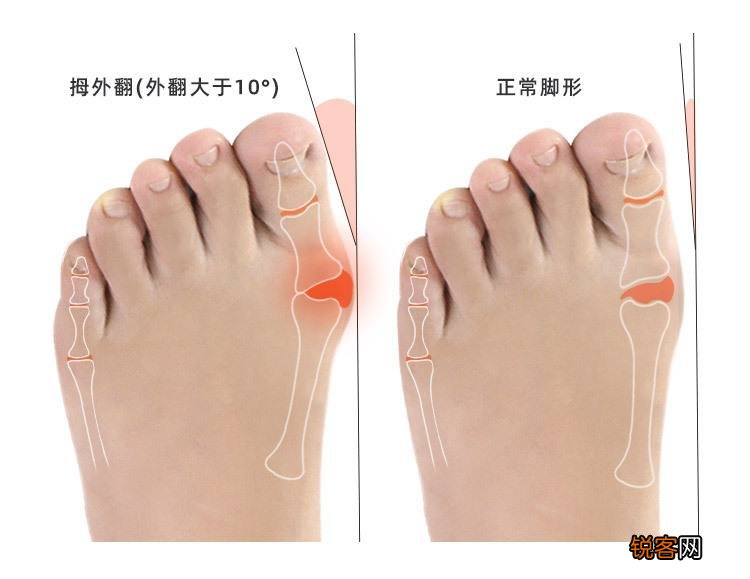 如何挑选适合自己的鞋子 教你如何根据自己的脚型，挑选ZUI合适的鞋子