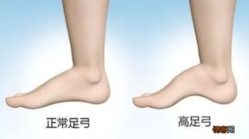 如何挑选适合自己的鞋子 教你如何根据自己的脚型，挑选ZUI合适的鞋子