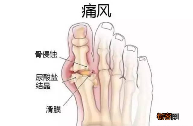 降尿酸吃什么食物好 尿酸高应该少吃点什么