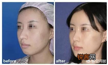 为什么很多女生正脸漂亮,侧脸却一般呢？