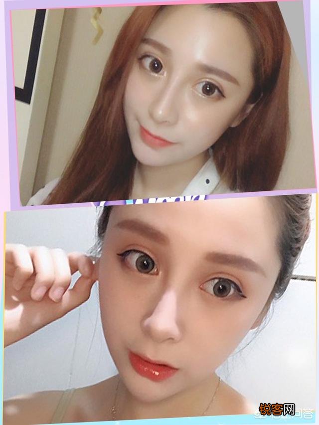 双眼皮有哪几种类型,如何选择适合自己的双眼皮类型？