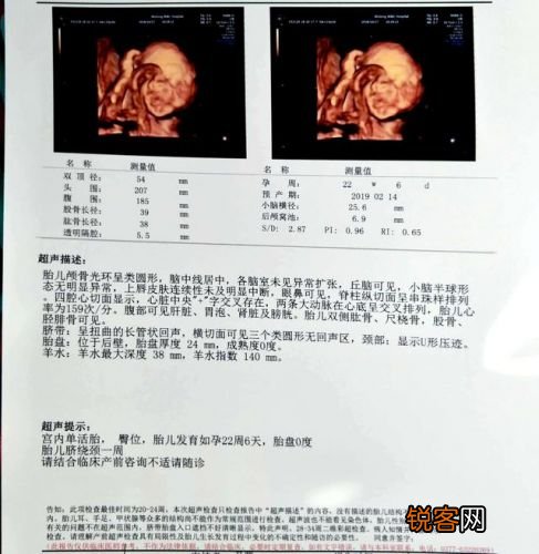 胎儿四维照片 胎儿四维彩超照片和真实一样吗