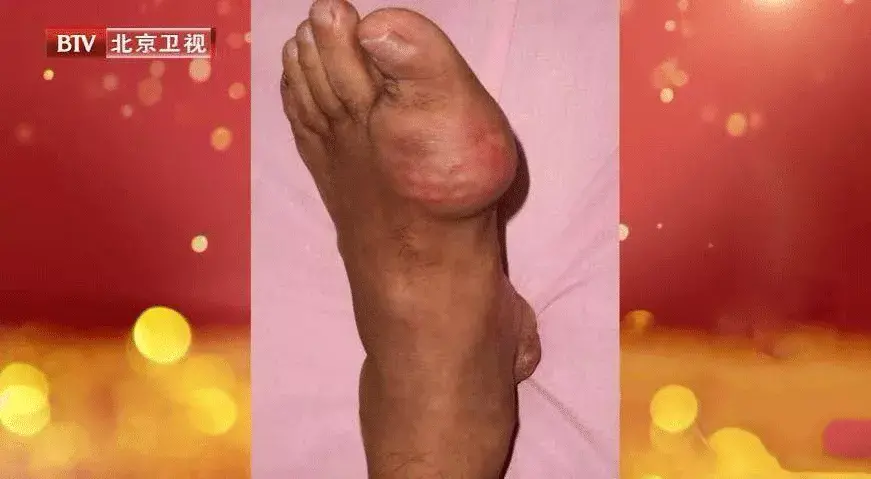 豆浆和牛奶哪个营养价值高 怎么选才是最适合自己的呢