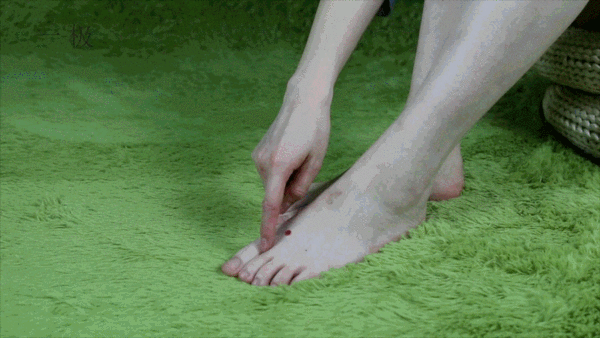 肝癌不痛不痒,出现2痣3少,要及时检查,别拖延！你知道是什么吗？