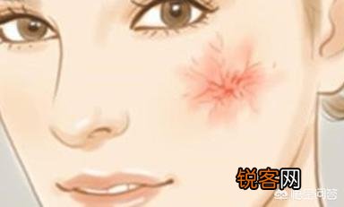 肝癌是酒“泡”出来的？提醒：早起有4个表现,快戒酒,查查肝,你知道是指什么吗？