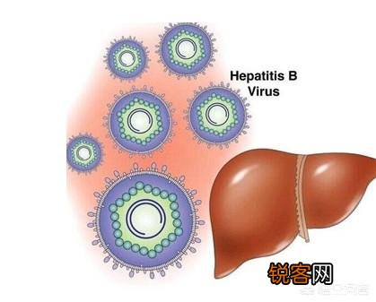 肝癌是酒“泡”出来的？提醒：早起有4个表现,快戒酒,查查肝,你知道是指什么吗？