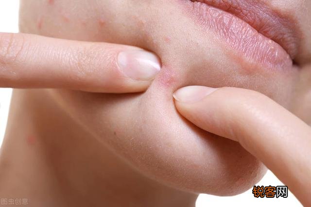 肝脏开始病变,会在身上长哪2种痣？在身体哪个部位？