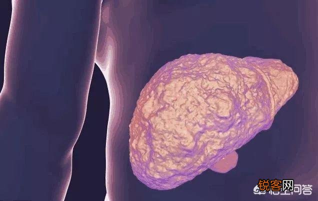 有人说一旦“脸上”有这3种表现,十有八九是“肝毒”太深了,指的是什么？