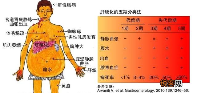 32岁男子,肝硬化入院,提醒：身上若有\＂2红\＂,及时就医检查,具体指什么？