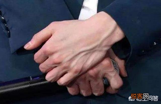 ?有人说肝不好的人,手上会出现“一处变细,二处发红,三处异常”,具体指的是什么?肝不好怎样养护?
