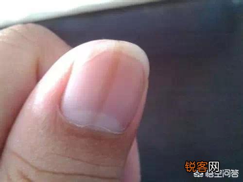 ?有人说肝不好的人,手上会出现“一处变细,二处发红,三处异常”,具体指的是什么?肝不好怎样养护?
