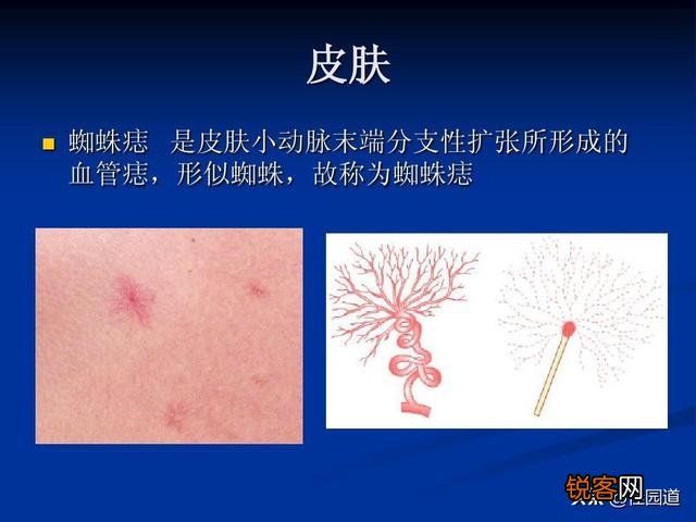 ?有人说肝不好的人,手上会出现“一处变细,二处发红,三处异常”,具体指的是什么？肝不好怎样养护？