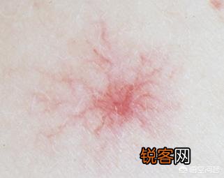 ?有人说肝不好的人,手上会出现“一处变细,二处发红,三处异常”,具体指的是什么?肝不好怎样养护?