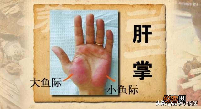 手上有小红点是什么原因？
