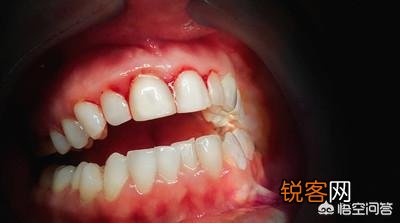 肝癌不是突然到来,有人说身体出现2臭、3痛、4红,已经提前通知了,指的是什么？
