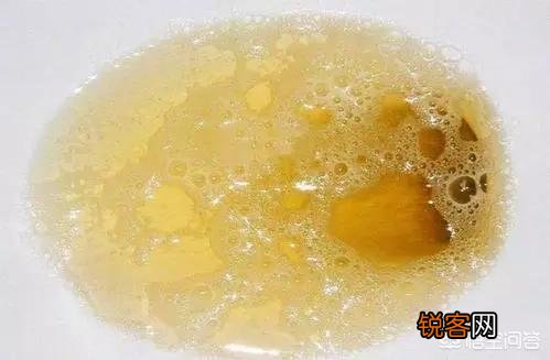 不管男女,身体出现这种“红痣”,说明你的肝脏病变了,究竟指的什么样的红痣？