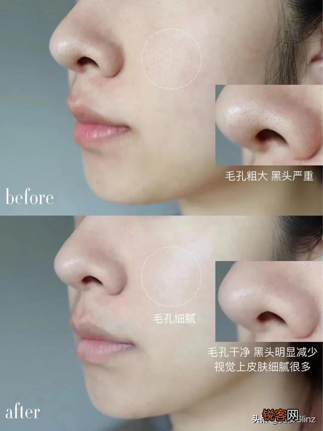 什么护肤品最好用？