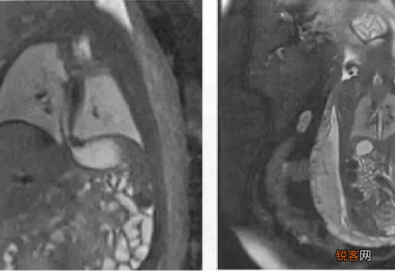 磁共振什么意思