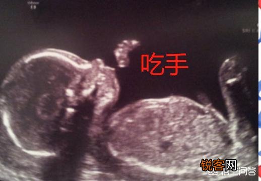 26周做四维彩超,图片显示宝宝在吃手是什么情况？