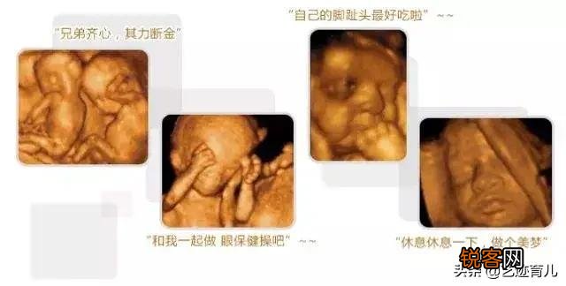 26周做四维彩超,图片显示宝宝在吃手是什么情况？