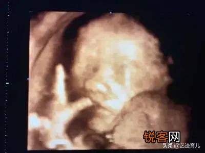 26周做四维彩超,图片显示宝宝在吃手是什么情况？