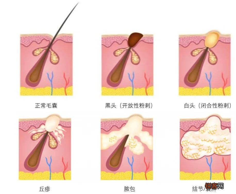 廉价感的女生 都有这些特点