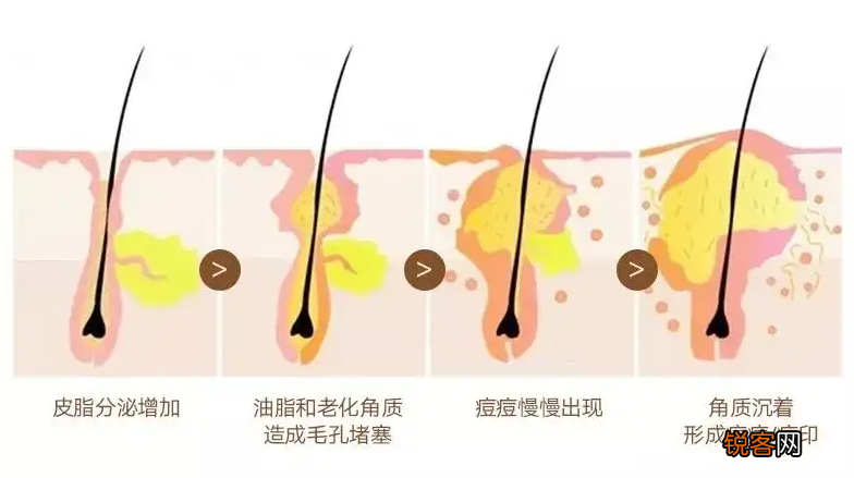 廉价感的女生 都有这些特点