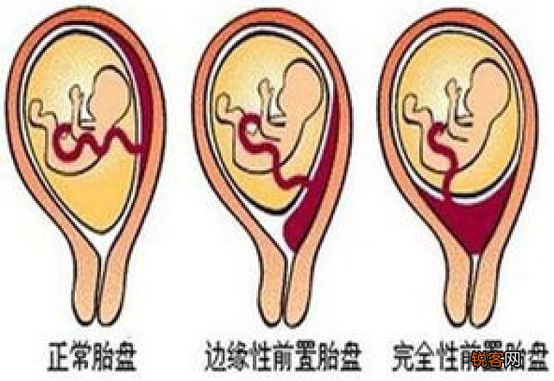 猪胎盘的功效与作用 猪胎盘的食用方式和注意事项