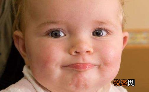 宝宝流口水让妈妈们头疼 宝宝流口水的中医治疗