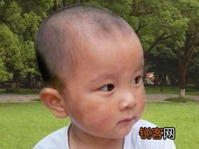 白斑的危害有哪些？日常应该注意什么？