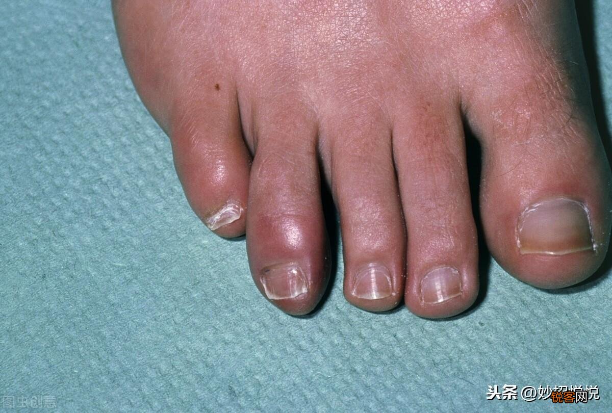 教你辣椒的7种妙用方法 辣椒除了吃还有什么用途