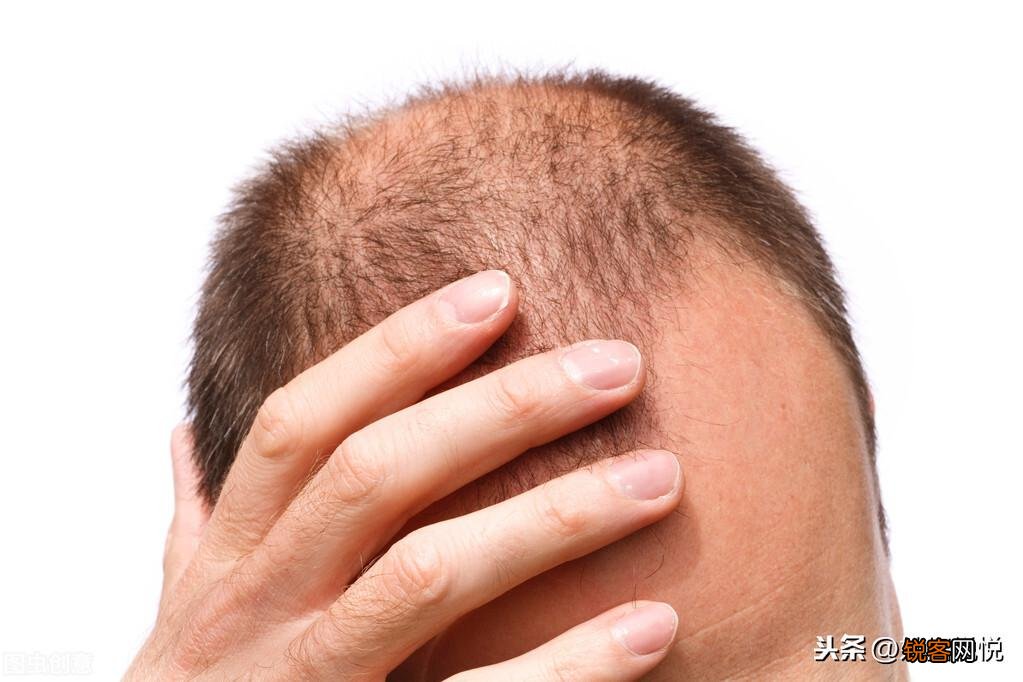 教你辣椒的7种妙用方法 辣椒除了吃还有什么用途