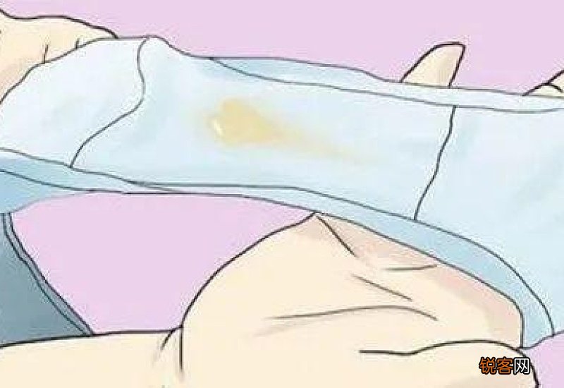 女性白带异常有哪些 女性白带异常该怎么办