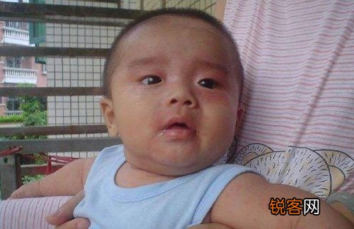 小儿结核的晚期症状有哪些？饮食上应留意什么成绩