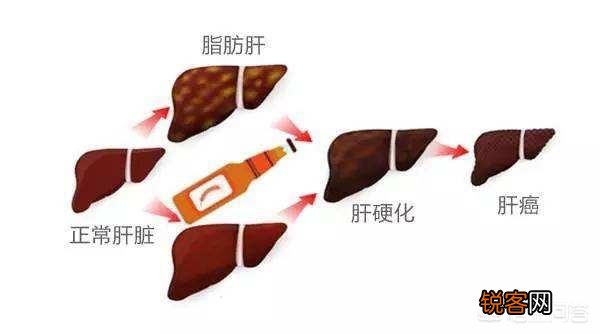 喝酒导致肝损伤,戒酒后肝功能会恢复正常吗？